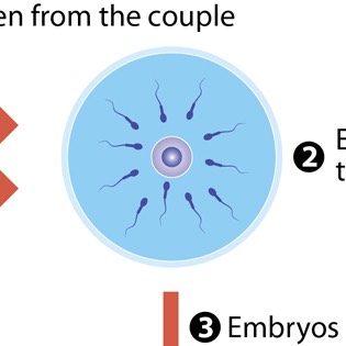 IVF treatment infographic 