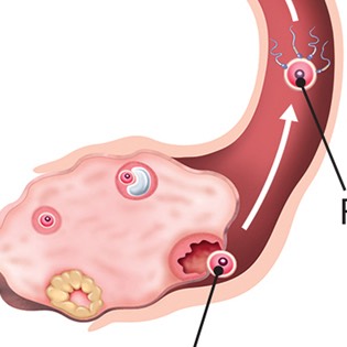 Germinal period 