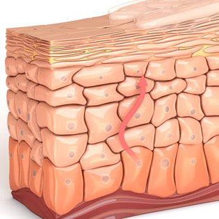 Hydroboost skin layers 