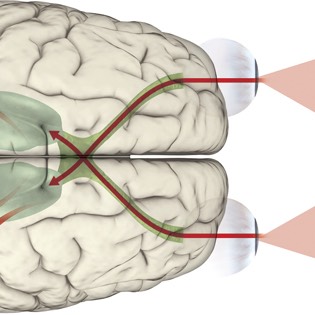 Sight diagram 