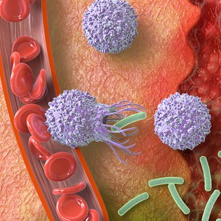 Infection diagram 